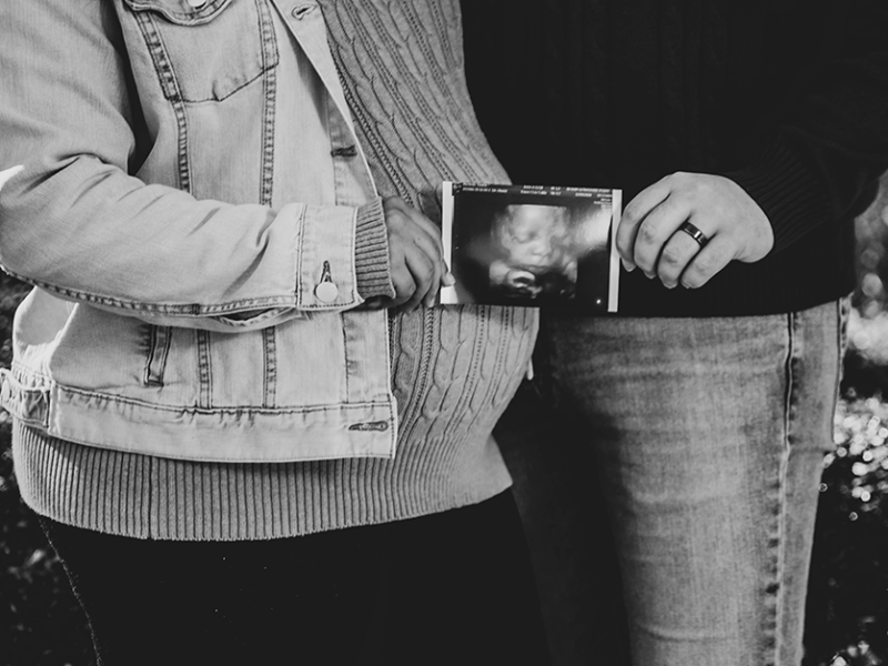 Ultrasound image of a baby